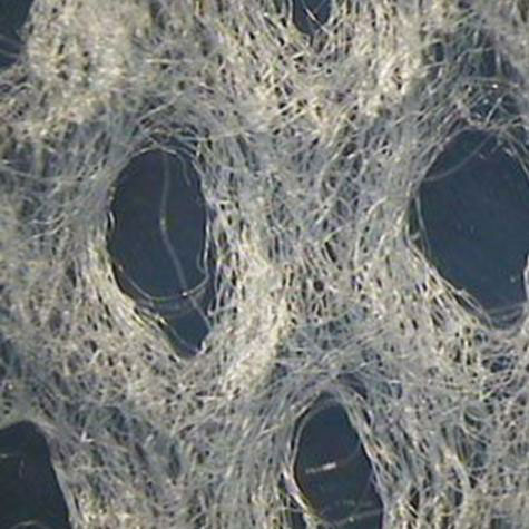 Medical nonwovens come to rescue for Chinas textile economy